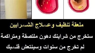 ملعقة تنظيف وعلاج الشرايين: ستخرج من شرايينك دون ملتصقة ومتراكمة