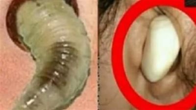انظر ماذا سيحدث عندما تضع البصل في هذه المنطقة من جسمك !!