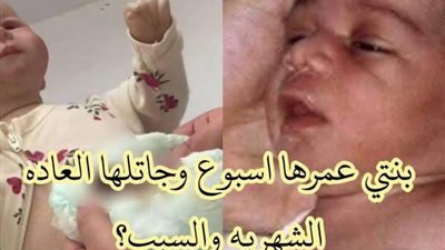 بنتى عندها اسبوع 