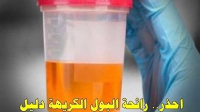 احذر رائحة البول الكريهة دليل على إصابتك بـ 4 أمراض