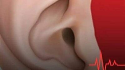 أعراض أمراض القلب.. 4 علامات غامضة تظهر في الأذن وتنذرك قبل فوات الأوان